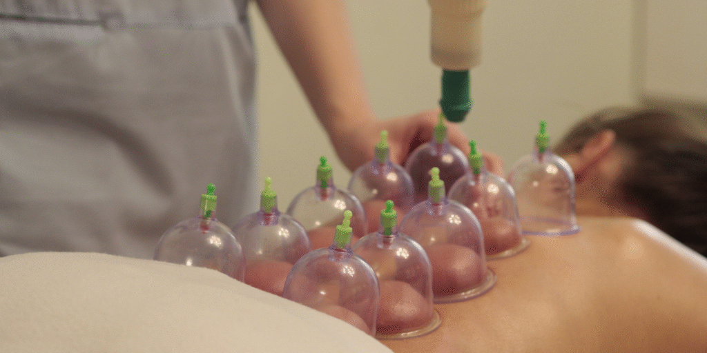 Cupping therapy