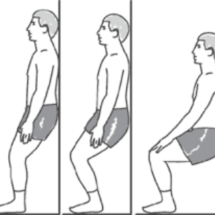 Exercise After Knee Replacement