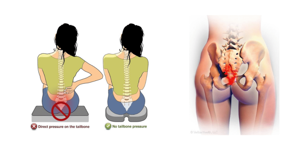 Tailbone pain treatment in jaipur​