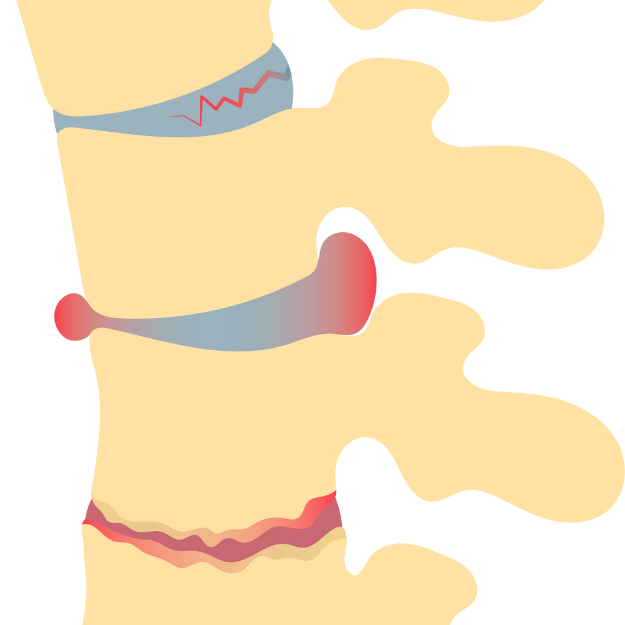 Best Chiropractor in jagatpura